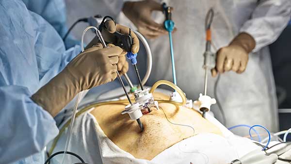 coelioscopie laparoscopie urologue paris urologue region parisienne urologie chirurgie chirurgien urologue paris dr elalouf